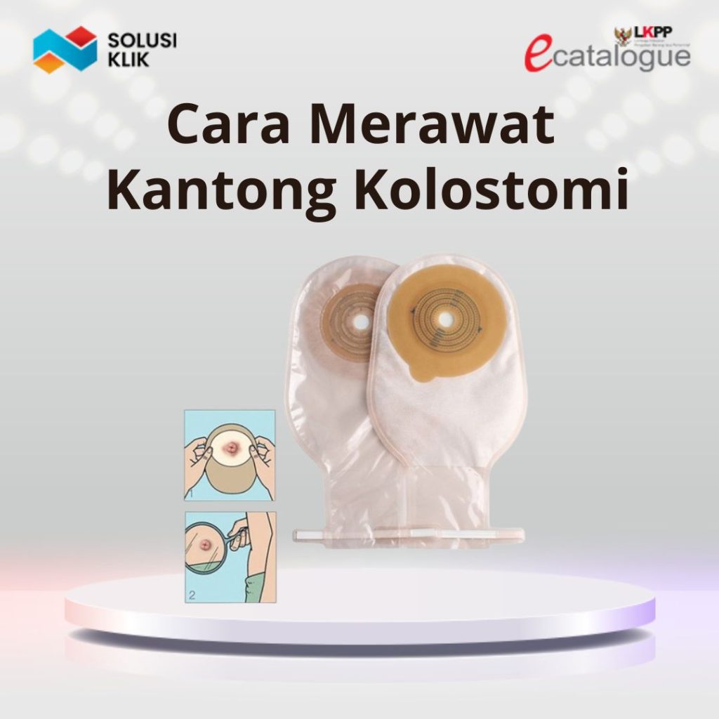 6 Cara Merawat Kantong Kolostomi